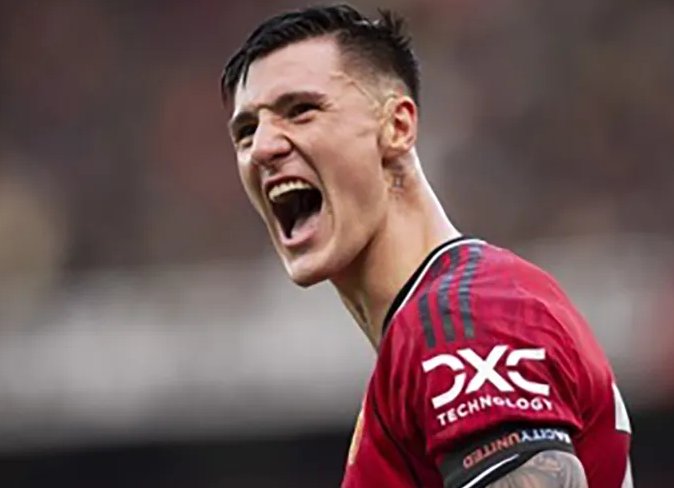 Sesko khiến huyền thoại MU bối rối. ẢNH: EPA