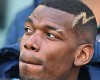 Hé lộ ngày trở lại thi đấu của Pogba có thể là tháng 11. ẢNH: EPA
